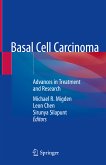 Basal Cell Carcinoma (eBook, PDF)