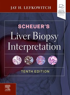 Scheuer's Liver Biopsy Interpretation - Lefkowitch, Jay H