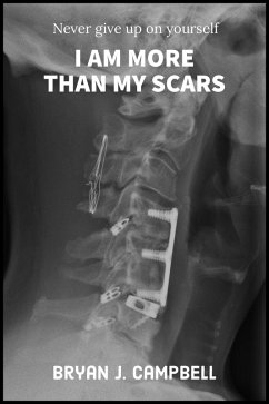 I Am More Than My Scars - Never Give Up On Yourself (eBook, ePUB) - Campbell, Bryan