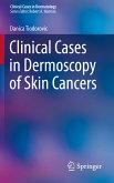 Clinical Cases in Dermoscopy of Skin Cancers (eBook, PDF)
