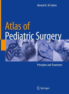 Atlas of Pediatric Surgery (eBook, PDF) - Al-Salem, Ahmed H.