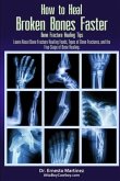 How to Heal Broken Bones Faster. Bone Fracture Healing Tips