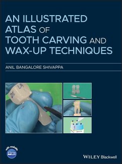An Illustrated Atlas of Tooth Carving and Wax-Up Techniques - Bangalore Shivappa, Anil