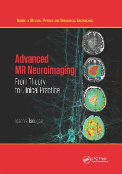 Advanced MR Neuroimaging - Tsougos, Ioannis