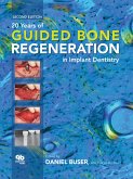 20 Years of Guided Bone Regeneration in Implant Dentistry (eBook, PDF)