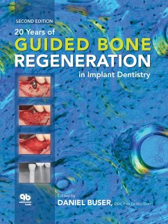 Cover 20 Years of Guided Bone Regeneration in Implant Dentistry (eBook, ePUB)