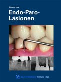 Endo-Paro-Läsionen (eBook, ePUB)