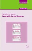 Removable Partial Dentures (eBook, ePUB)