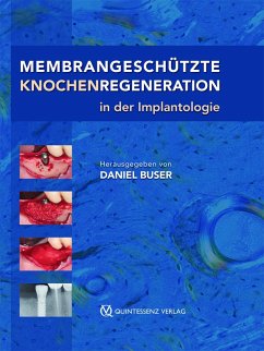 Membrangeschützte Knochenregeneration in der Implantologie (eBook, ePUB) - Buser, Daniel
