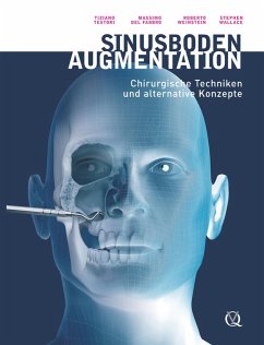 Cover Sinusbodenaugmentation (eBook, ePUB)