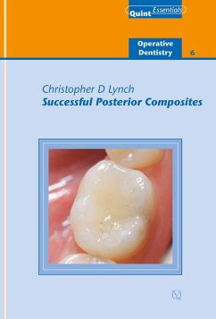 Cover Successful Posterior Composites (eBook, ePUB)