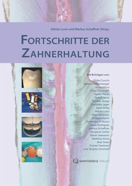 Fortschritte der Zahnerhaltung (eBook, ePUB) Fortschritte der Zahnerhaltung (eBook, ePUB)