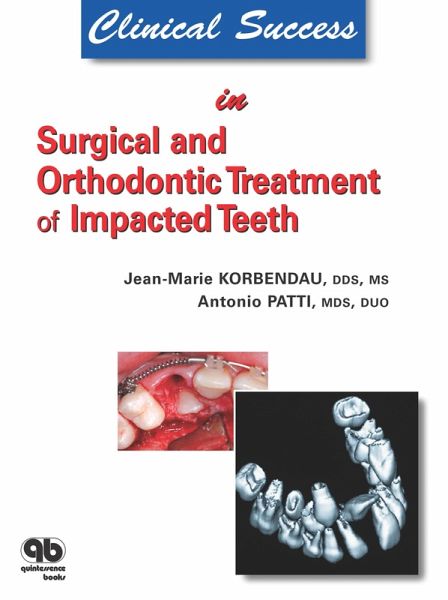 Clinical Success in Surgical and Orthodontic Treatment of Impacted Teeth (eBook, ePUB) Clinical Success in Surgical and Orthodontic Treatment of Impacted Teeth (eBook, ePUB)