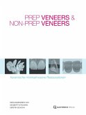 Prep Veneers und Non-Prep Veneers (eBook, ePUB)