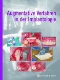 Augmentative Verfahren in der Implantologie (eBook, ePUB)