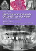 Bisphosphonat-induzierte Osteonekrose der Kiefer (eBook, ePUB)