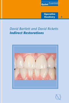 Cover Indirect Restorations (eBook, ePUB)