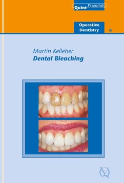 Cover Dental Bleaching (eBook, ePUB)