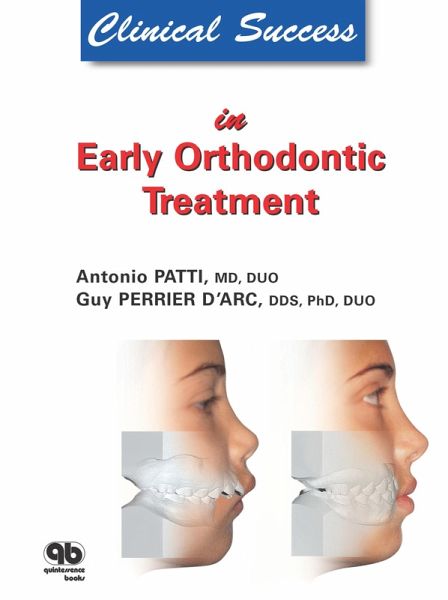 Clinical Success in Early Orthodontic Treatment (eBook, ePUB)