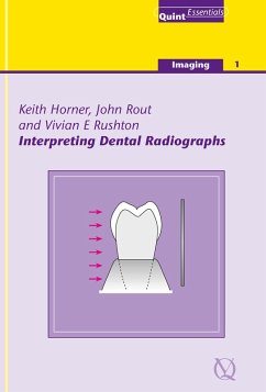Cover Interpreting Dental Radiographs (eBook, ePUB)