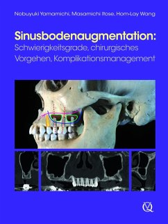 Sinusbodenaugmentation (eBook, ePUB) - Yamamichi, Nobuyuki; Itose, Masamichi; Wang, Hom-Lay