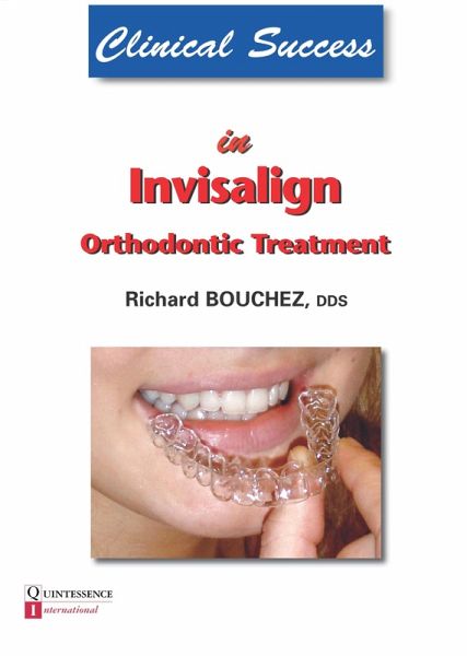 Clinical Success in Invisalign Orthodontic Treatment (eBook, ePUB) Clinical Success in Invisalign Orthodontic Treatment (eBook, ePUB)