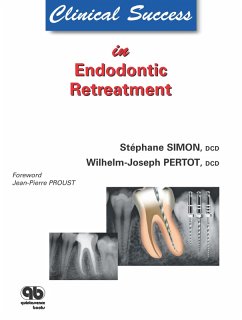 Clinical Success in Endodontic Retreatment (eBook, ePUB) - Simon, Stéphane; Pertot, Wilhelm-J.