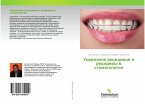 Uderzhanie recidiwow i recidiwy w stomatologii