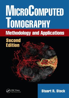 MicroComputed Tomography (eBook, ePUB) - Stock, Stuart R.