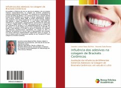 Influência dos adesivos na colagem de Brackets Cerâmicos - Dal Polo, Leandro Lorenzi Rasia;Reston, Eduardo Galia