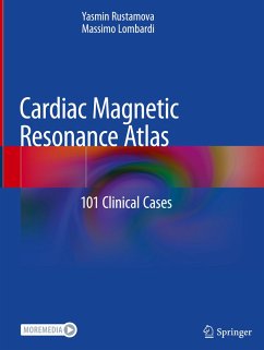 Cardiac Magnetic Resonance Atlas - Rustamova, Yasmin;Lombardi, Massimo