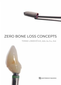 Cover Zero Bone Loss Concepts (eBook, ePUB)