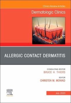 Allergic Contact Dermatitis, an Issue of Dermatologic Clinics - Mowad, Christen M.