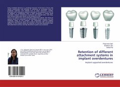 Retention of different attachment systems in implant overdentures - Ojah, Polysmita;Jain, Shailesh;Pal, Ankita