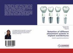 Retention of different attachment systems in implant overdentures