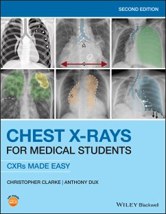 Chest X-Rays for Medical Students (eBook, ePUB) - Clarke, Christopher; Dux, Anthony