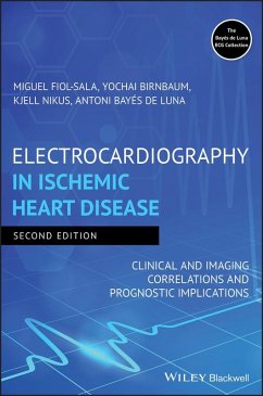 Electrocardiography in Ischemic Heart Disease - Fiol-Sala, Miquel; Birnbaum, Yochai; Nikus, Kjell; Bayés de Luna, Antoni