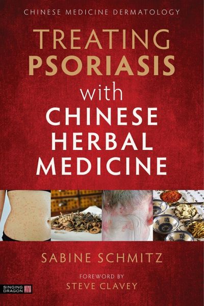 Treating Psoriasis with Chinese Herbal Medicine (Revised Edition) (eBook, ePUB) Treating Psoriasis with Chinese Herbal Medicine (Revised Edition) (eBook, ePUB)