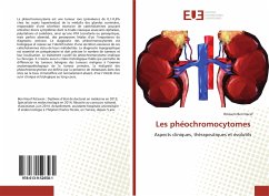 Les phéochromocytomes - Ben Nacef, Ibtissem