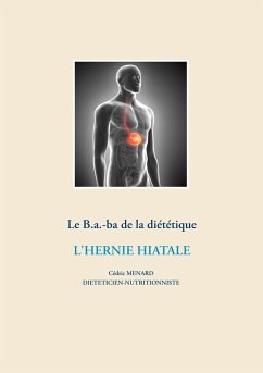 Le B.a.-ba diététique de l'hernie hiatale