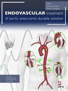 Endovascular treatment of aortic aneurysms: durable solution (eBook, PDF) - Gargiulo, Mauro; Nano, Giovanni