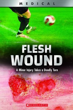 Flesh Wound: A Minor Injury Takes a Deadly Turn (Xbooks) - Phillips, Shea