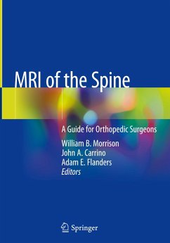 MRI of the Spine