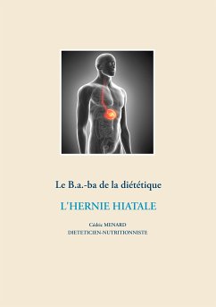 Le B.a.-ba diététique de l'hernie hiatale (eBook, ePUB)