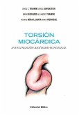 Torsión miocárdica (eBook, ePUB)