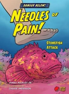 Needles of Pain!: Stonefish Attack - Buckley James Jr.