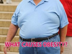 Cover WHAT CAUSES OBESITY? (eBook, ePUB)