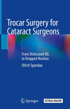 Trocar Surgery for Cataract Surgeons (eBook, PDF) - Spandau, Ulrich