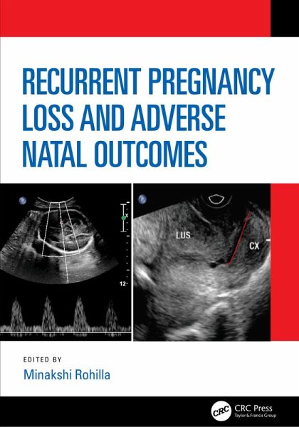 Recurrent Pregnancy Loss and Adverse Natal Outcomes (eBook, PDF) Recurrent Pregnancy Loss and Adverse Natal Outcomes (eBook, PDF)