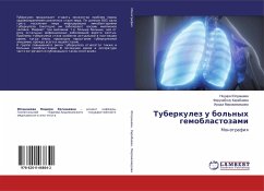 Tuberkulez u bol'nyhgemoblastozami - Juldashewa, Nodira;Karabaewa, Feruzabonu;Mirzaahmedowa, Iroda